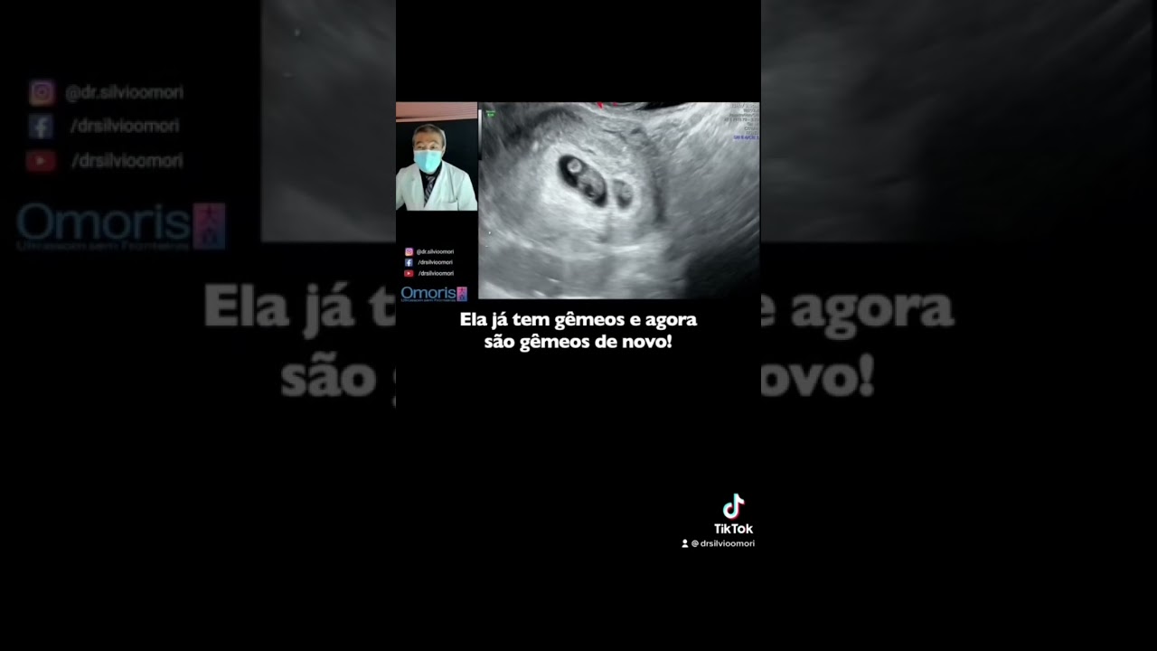 Surpresa no Ultrassom!! Gravidez Inicial #gravidez #grávida #ultrassom #gêmeos